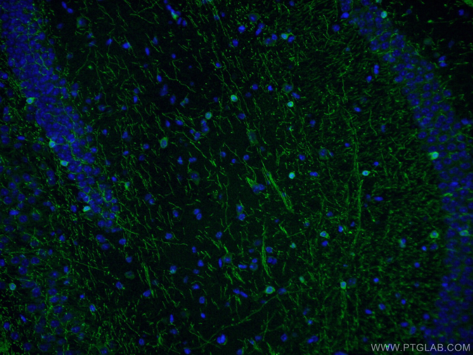 IF Staining of mouse brain using 13427-1-AP