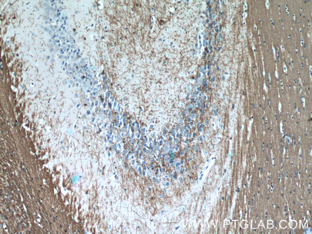 IHC staining of mouse brain using 13427-1-AP