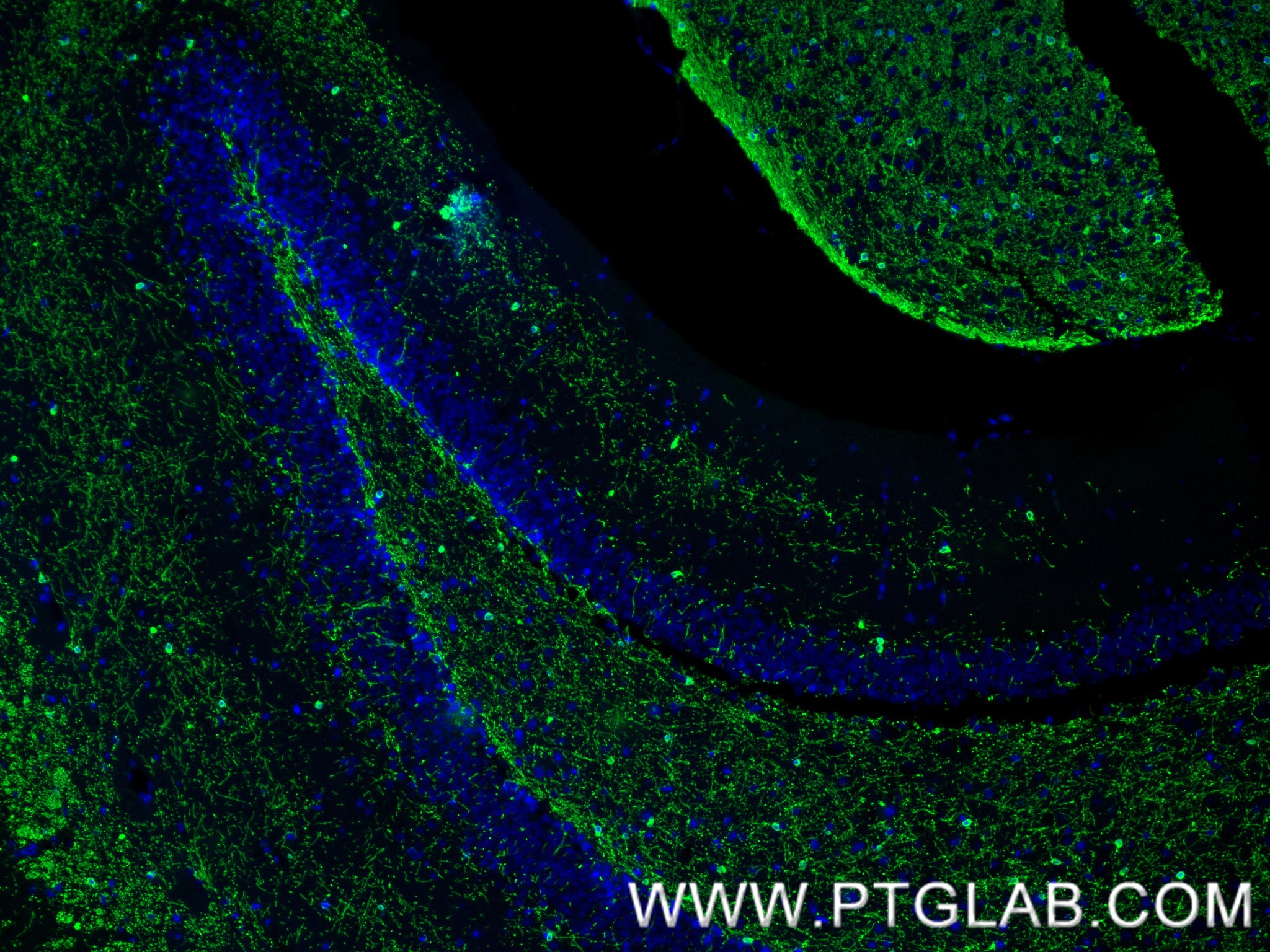 IF Staining of mouse brain using 86967-4-RR (same clone as 86967-4-PBS) IF Staining of mouse brain using 86967-4-RR (same clone as 86967-4-PBS)