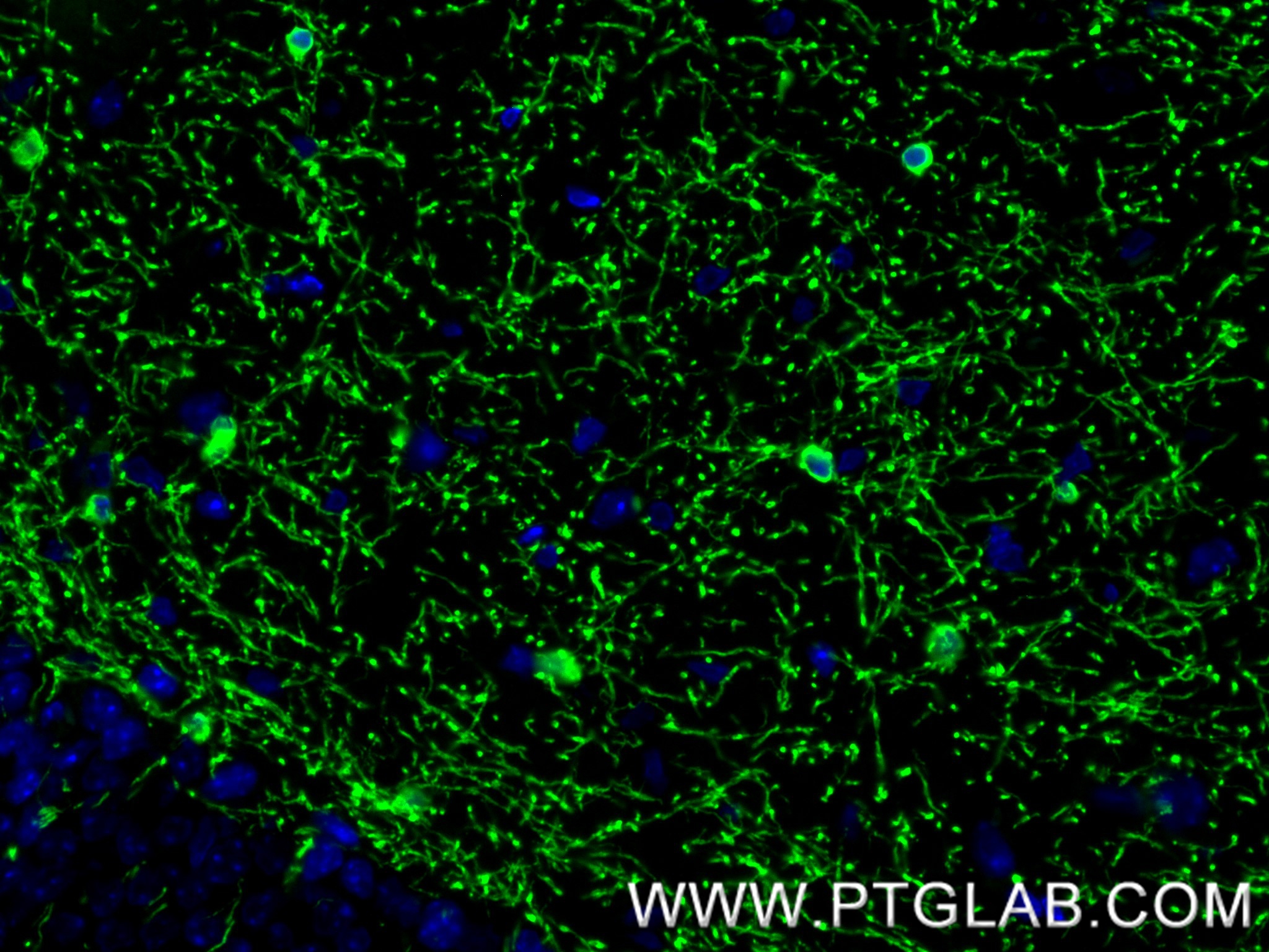 IF Staining of mouse brain using 86967-4-RR (same clone as 86967-4-PBS) IF Staining of mouse brain using 86967-4-RR (same clone as 86967-4-PBS)