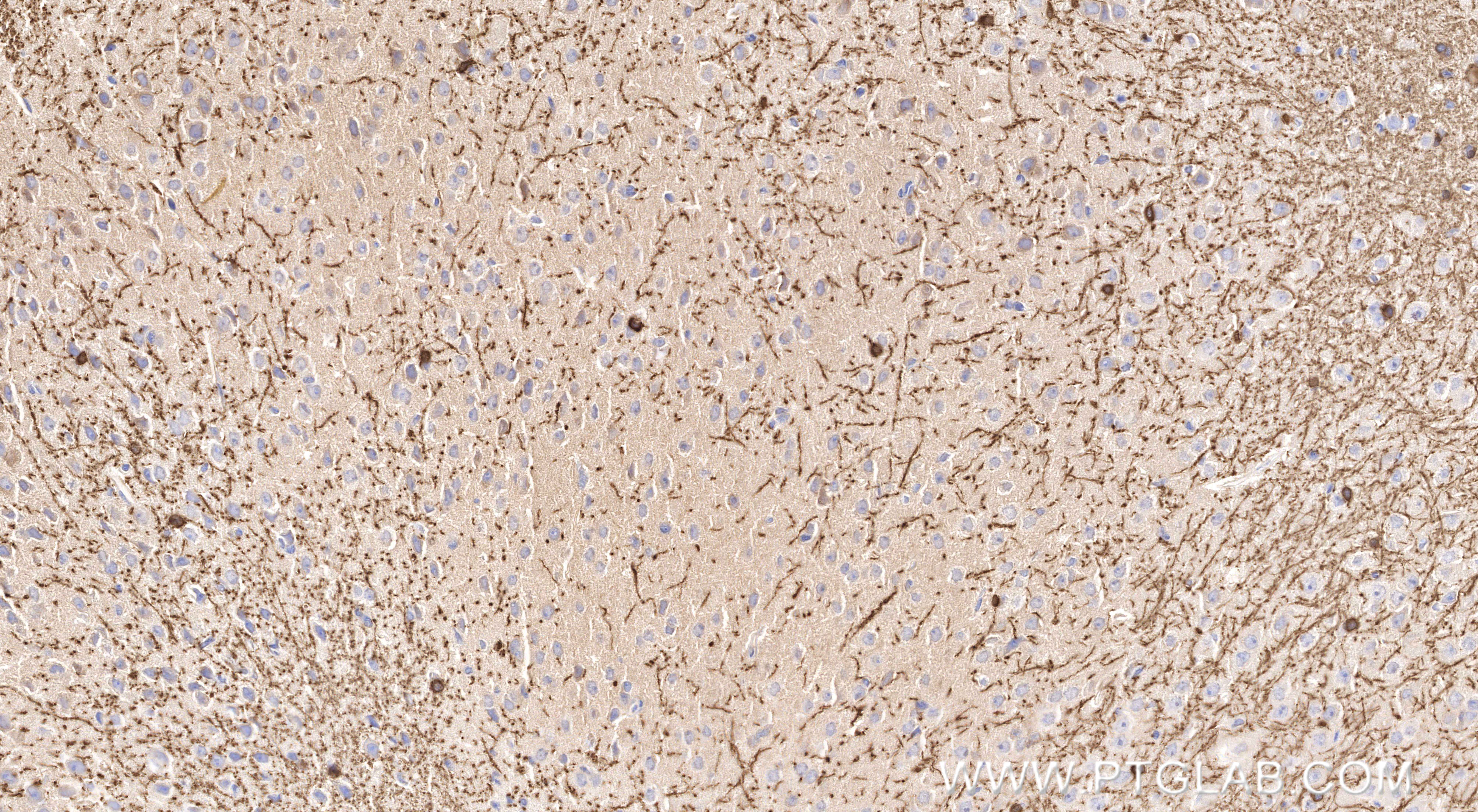 IHC staining of mouse brain using 86967-4-RR (same clone as 86967-4-PBS) IHC staining of mouse brain using 86967-4-RR (same clone as 86967-4-PBS)
