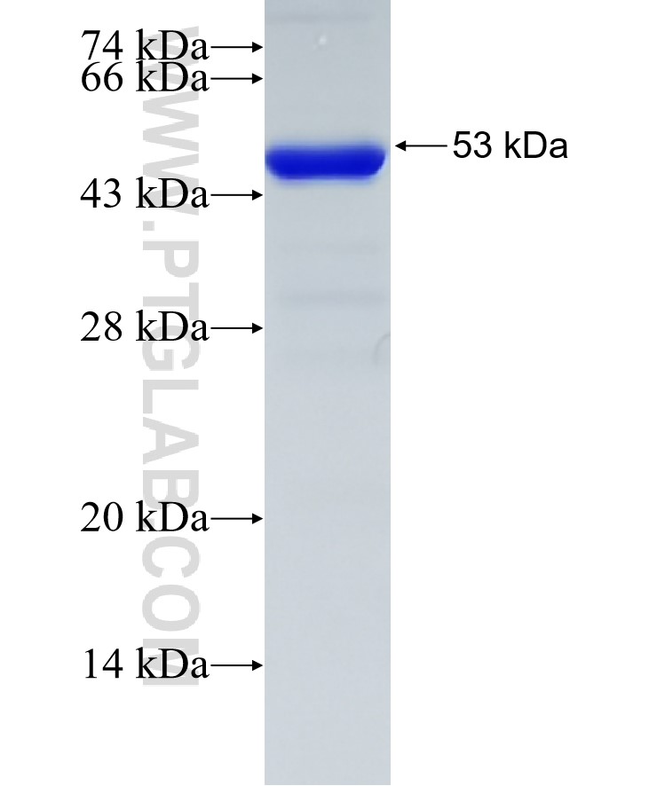 CNP fusion protein Ag4227 SDS-PAGE