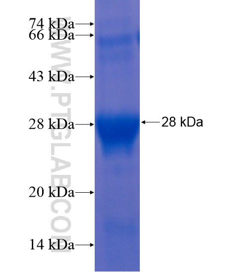 CNPY1 fusion protein Ag21160 SDS-PAGE