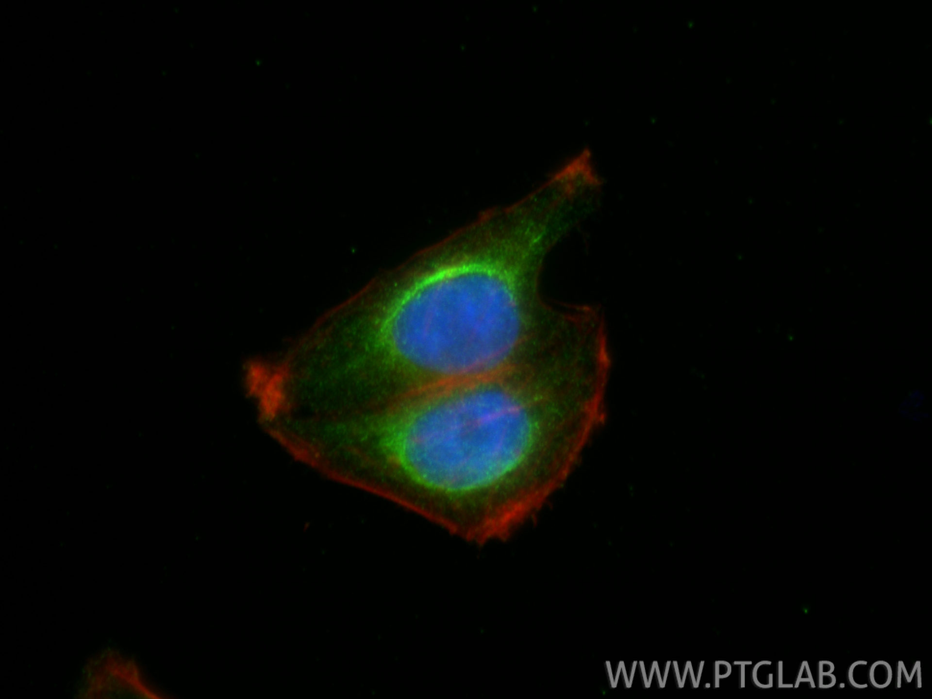 IF Staining of HepG2 using 66173-1-Ig (same clone as 66173-1-PBS)