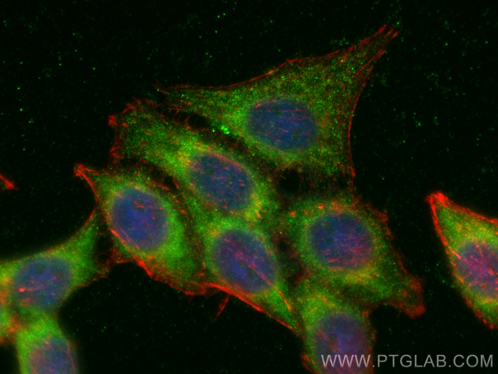 IF Staining of HepG2 using 14635-1-AP