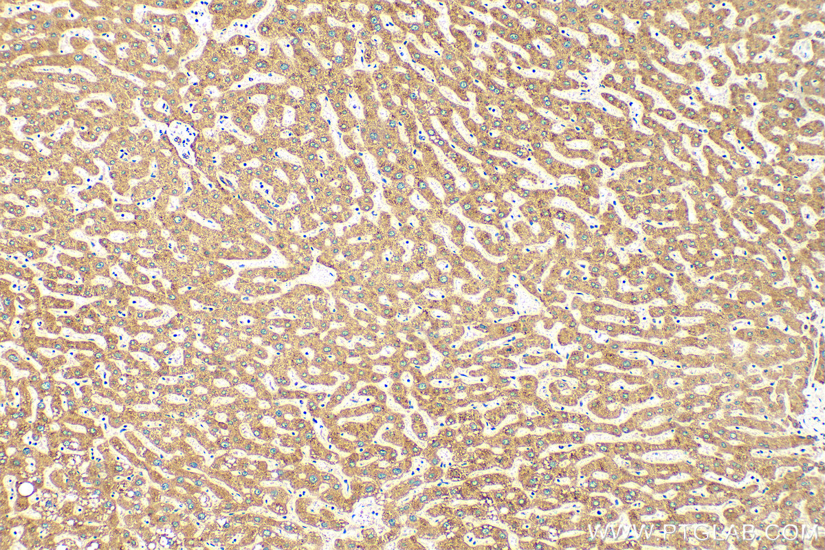 IHC staining of human liver using 14635-1-AP