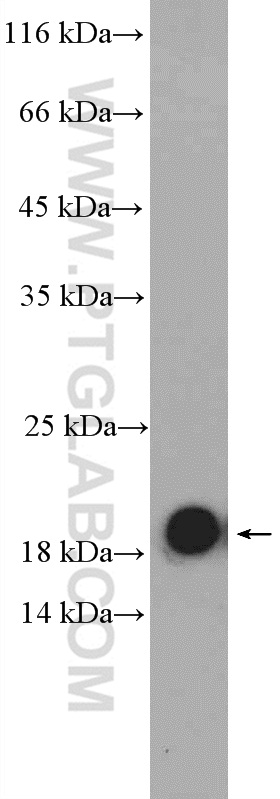WB analysis of mouse pancreas using 14635-1-AP