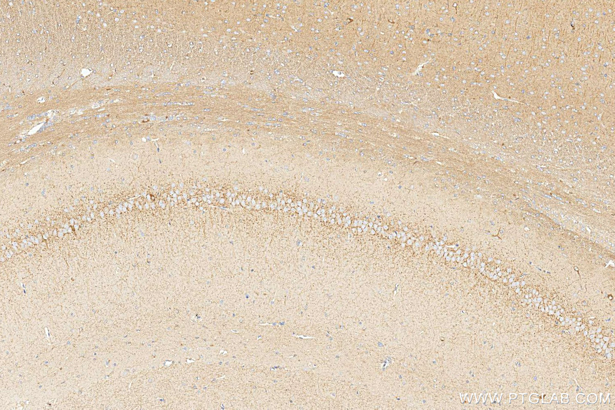 IHC staining of rat brain using 17978-1-AP IHC staining of rat brain using 17978-1-AP
