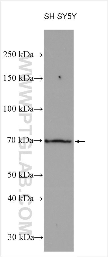 Cannabinoid receptor 1