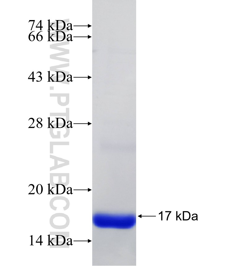 CNR1 fusion protein Ag31939 SDS-PAGE CNR1 fusion protein Ag31939 SDS-PAGE