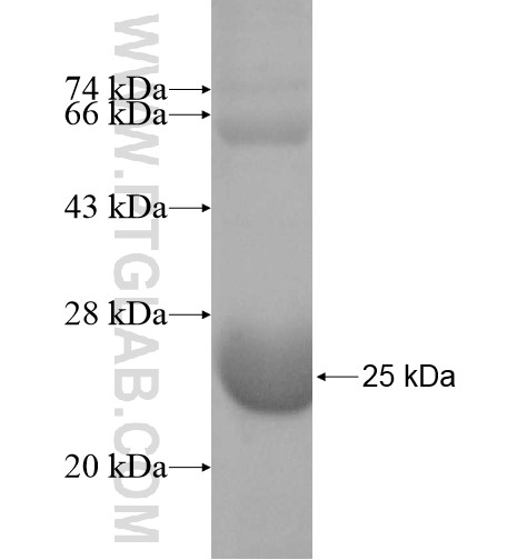 CNRIP1 fusion protein Ag10462 SDS-PAGE CNRIP1 fusion protein Ag10462 SDS-PAGE