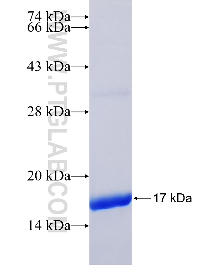 CNTD2 fusion protein Ag36441 SDS-PAGE CNTD2 fusion protein Ag36441 SDS-PAGE