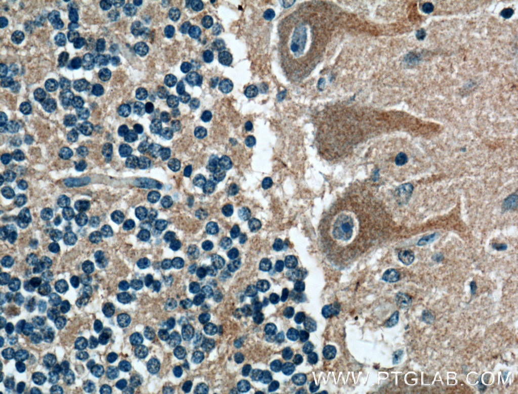 IHC staining of human cerebellum using 27342-1-AP