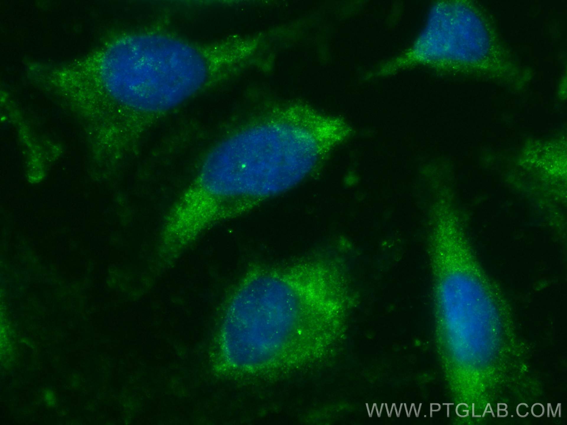 IF Staining of HeLa using 31698-1-AP
