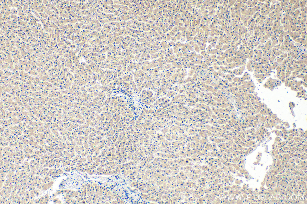 IHC staining of human liver using 31698-1-AP