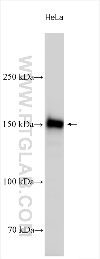 WB analysis using 31698-1-AP
