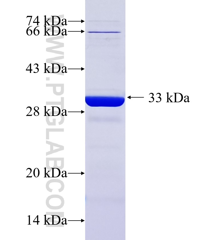 CNTLN fusion protein Ag36409 SDS-PAGE CNTLN fusion protein Ag36409 SDS-PAGE