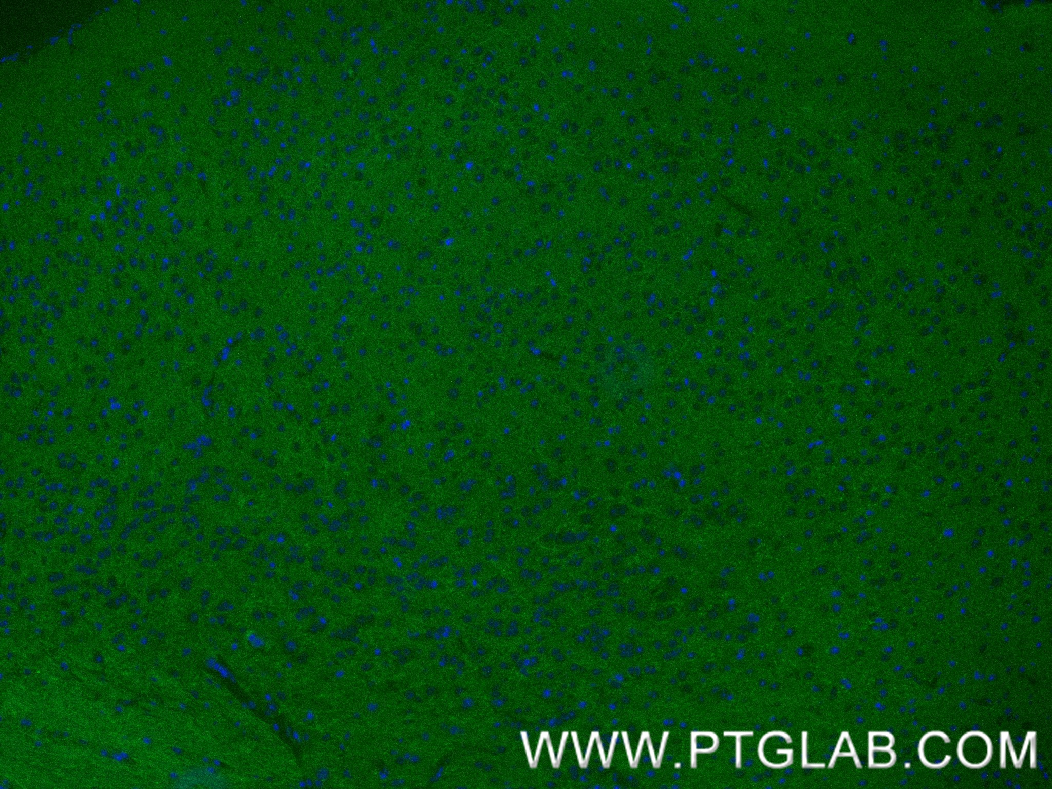 IF Staining of mouse brain using 87612-1-RR IF Staining of mouse brain using 87612-1-RR