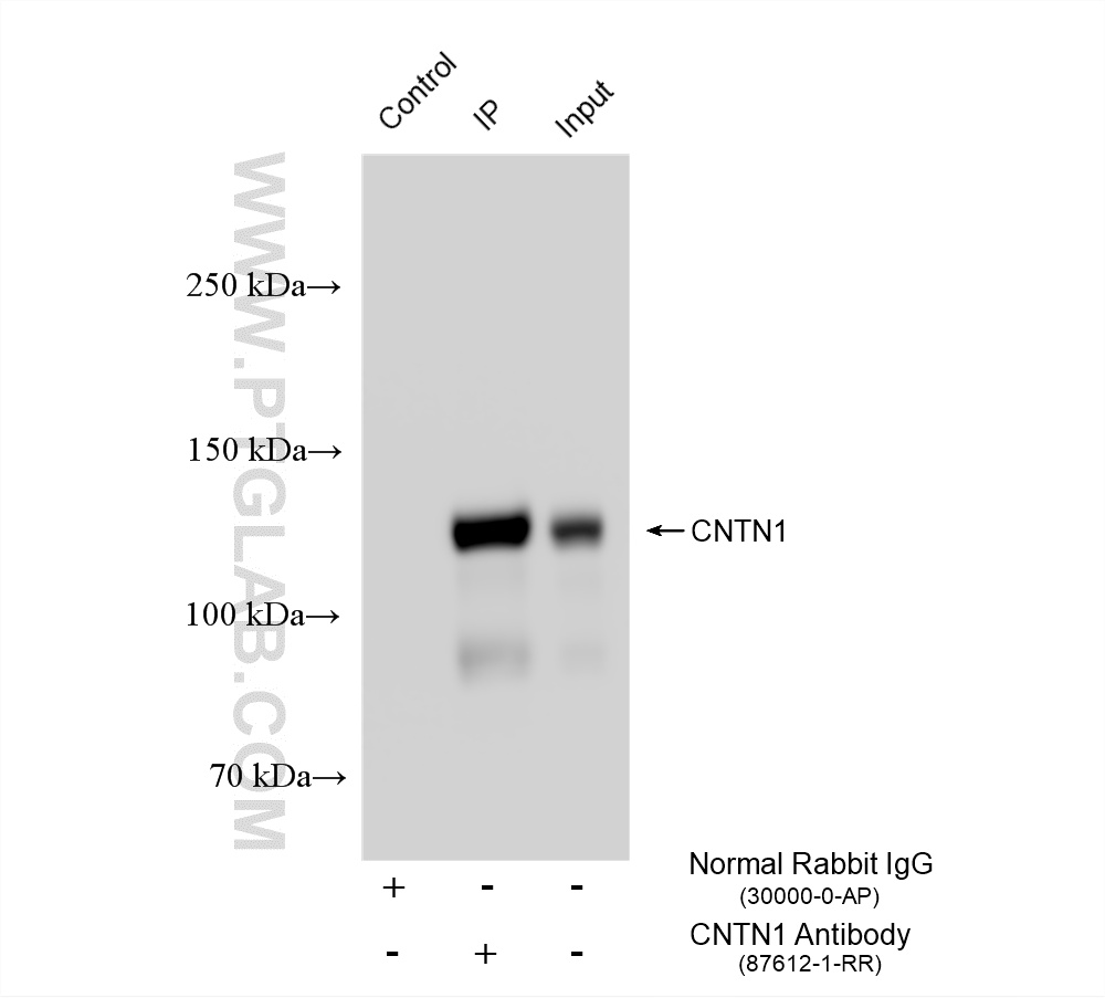 IP experiment of rat brain using 87612-1-RR (same clone as 87612-1-PBS) IP experiment of rat brain using 87612-1-RR (same clone as 87612-1-PBS)