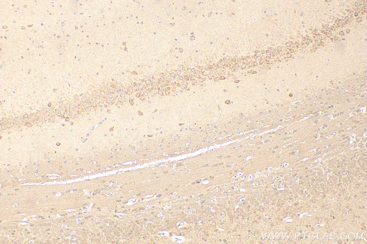 IHC staining of rat brain using 67089-1-Ig (same clone as 67089-1-PBS)