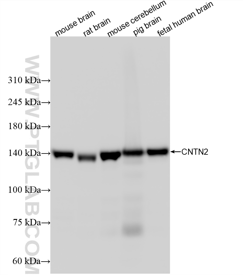Various lysates were subjected to SDS PAGE followed by western blot with <a class='green' href='/productredirect?CatalogNo=87574-1-RR' target='_blank'>87574-1-RR</a> (CNTN2 antibody) at dilution of 1:5000 incubated at room temperature for 1.5 hours. This data was developed using the same antibody clone with 87574-1-PBS in a different storage buffer formulation. WB analysis using 87574-1-RR (same clone as 87574-1-PBS)