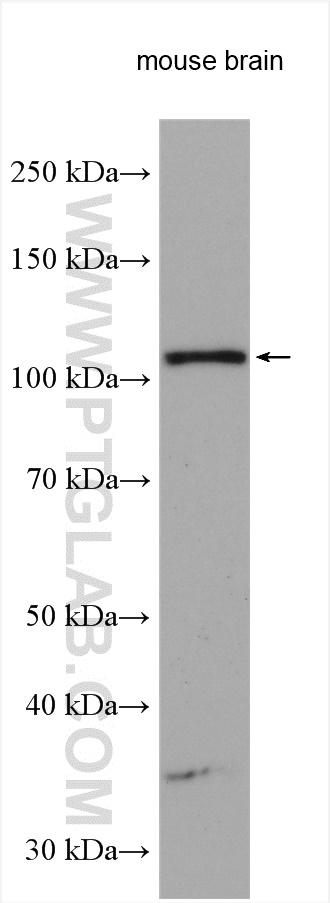 WB analysis of mouse brain using 12777-1-AP