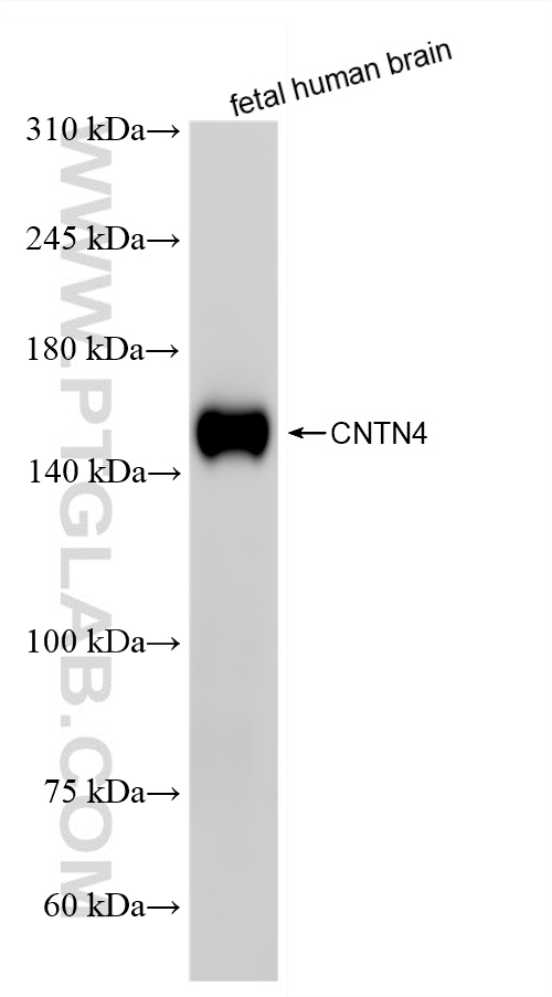 WB analysis of fetal human brain using 87572-1-RR (same clone as 87572-1-PBS) WB analysis of fetal human brain using 87572-1-RR (same clone as 87572-1-PBS)