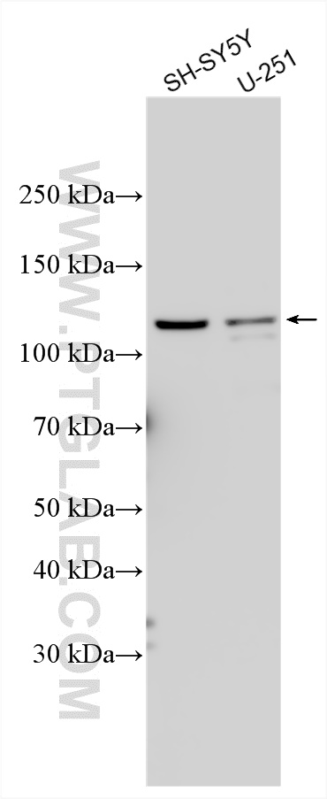 WB analysis using 27410-1-AP