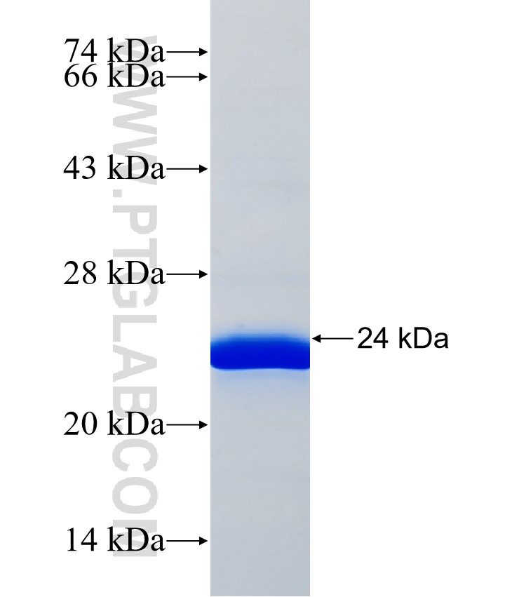 CNTNAP4 fusion protein Ag37558 SDS-PAGE CNTNAP4 fusion protein Ag37558 SDS-PAGE