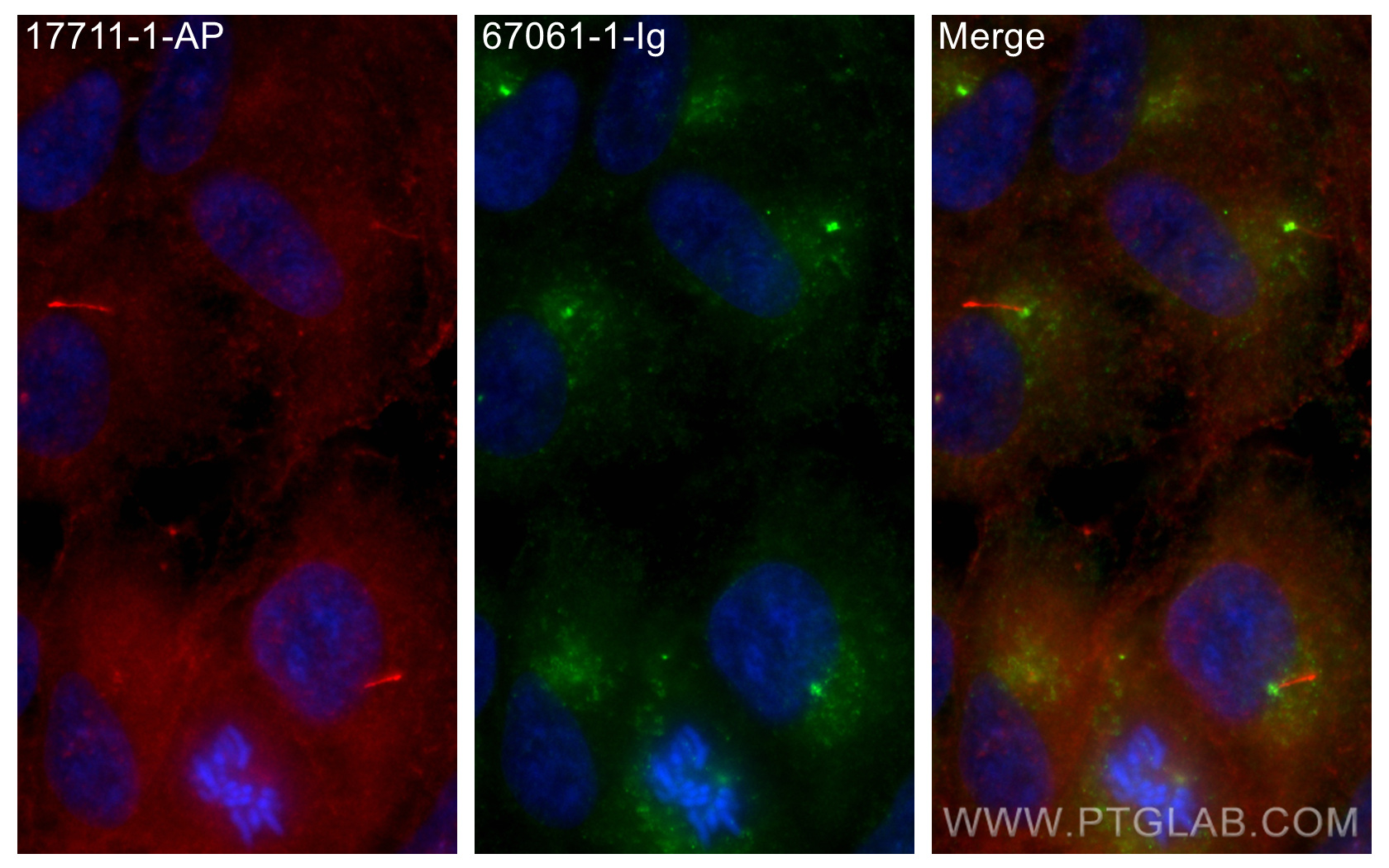 IF Staining of hTERT-RPE1 using 67061-1-Ig
