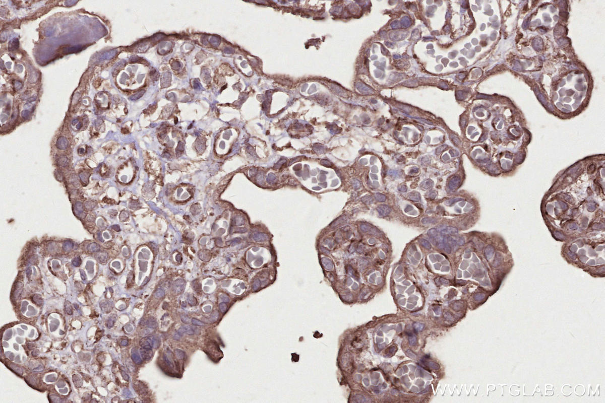 IHC staining of human placenta using 67061-1-Ig IHC staining of human placenta using 67061-1-Ig