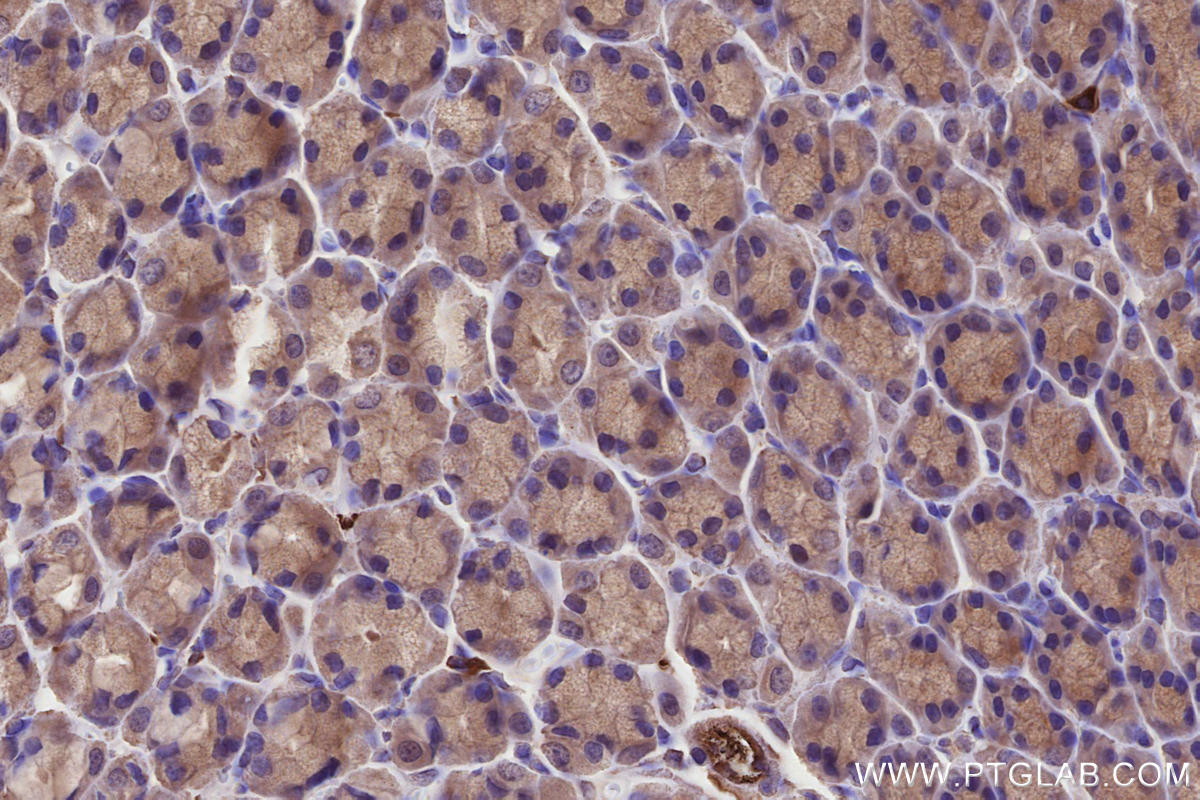 IHC staining of rat stomach using 67061-1-Ig IHC staining of rat stomach using 67061-1-Ig