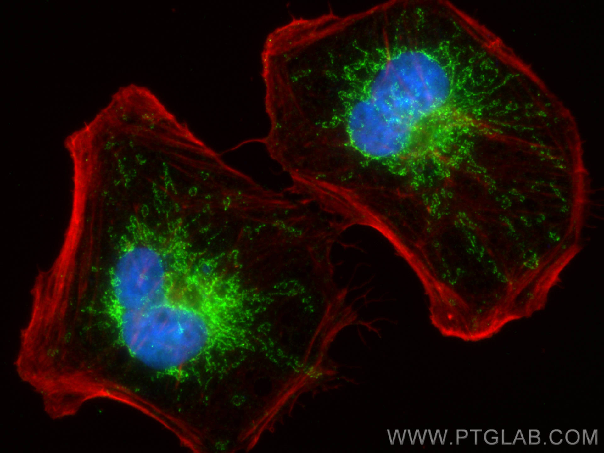 IF Staining of HeLa using 25197-1-AP