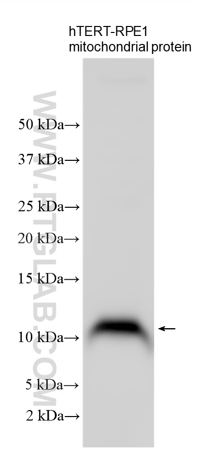 WB analysis using 34046-1-AP (same clone as 34046-1-PBS) WB analysis using 34046-1-AP (same clone as 34046-1-PBS)
