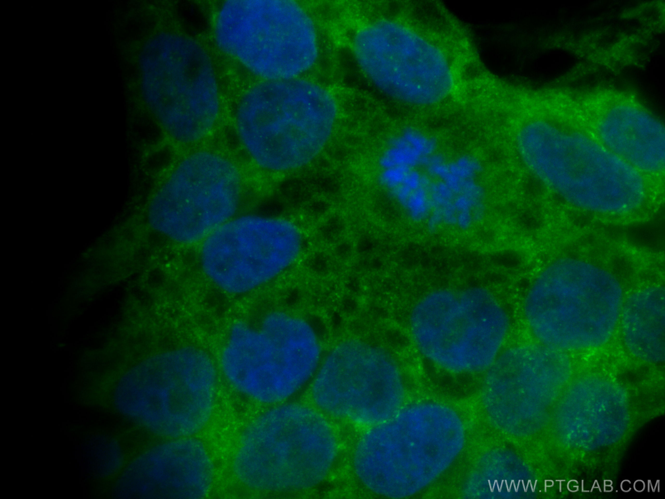 IF Staining of HaCaT using 31191-1-AP