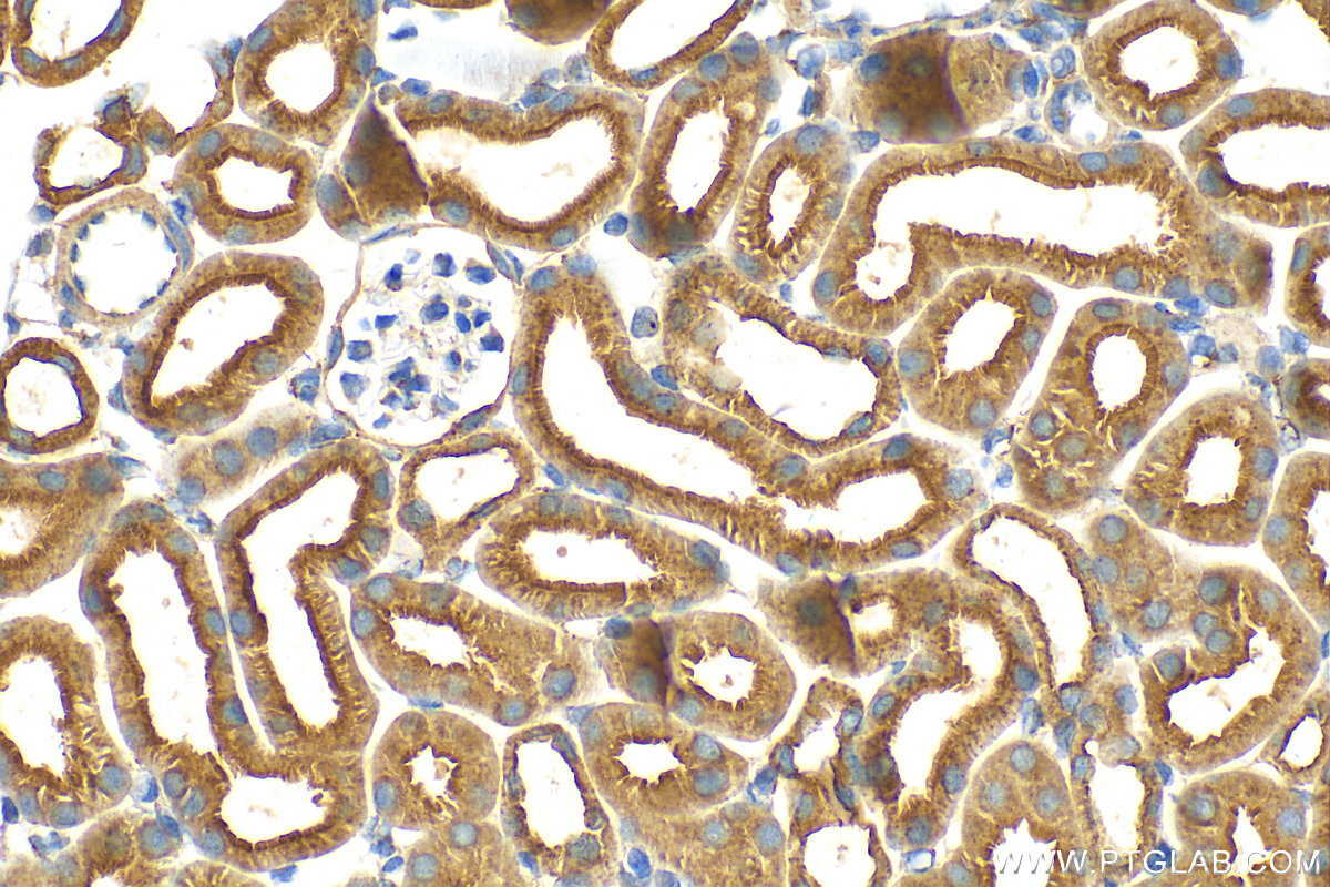 IHC staining of mouse kidney using 31191-1-AP