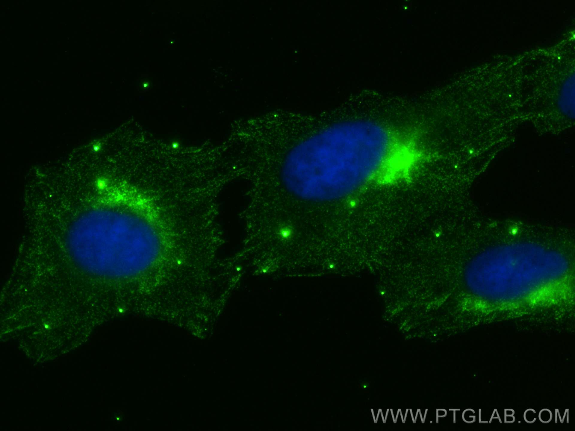 IF Staining of U2OS using 68642-1-Ig (same clone as 68642-1-PBS)