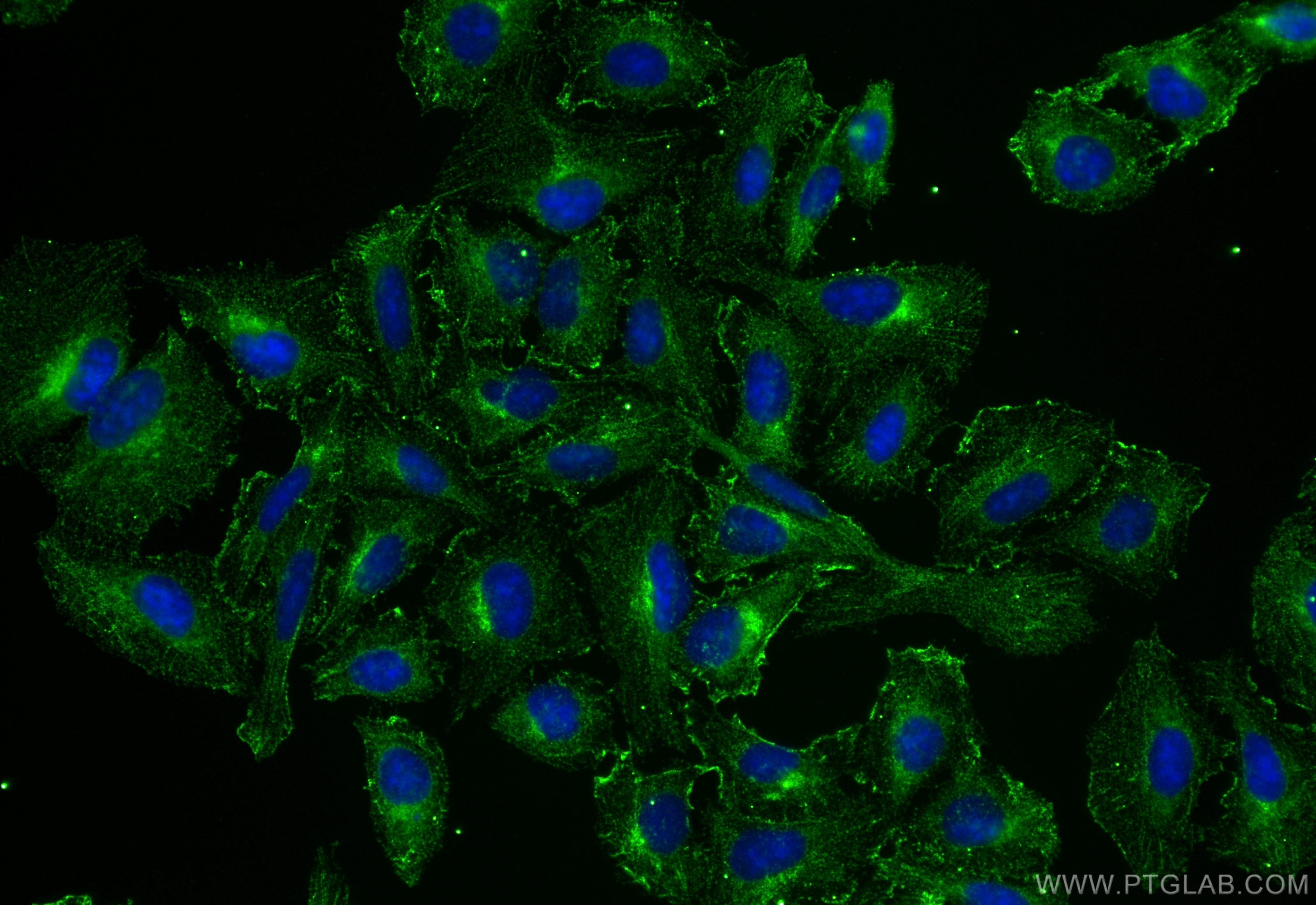 IF Staining of U2OS using 68642-1-Ig (same clone as 68642-1-PBS)