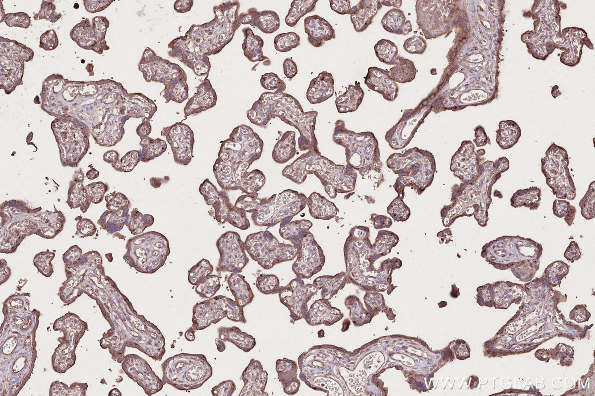 IHC staining of human placenta using 68642-1-Ig IHC staining of human placenta using 68642-1-Ig
