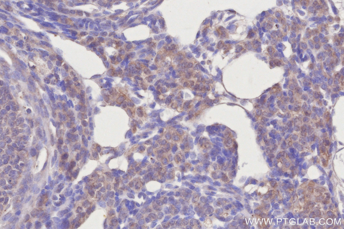 IHC staining of mouse ovary using 68642-1-Ig (same clone as 68642-1-PBS)
