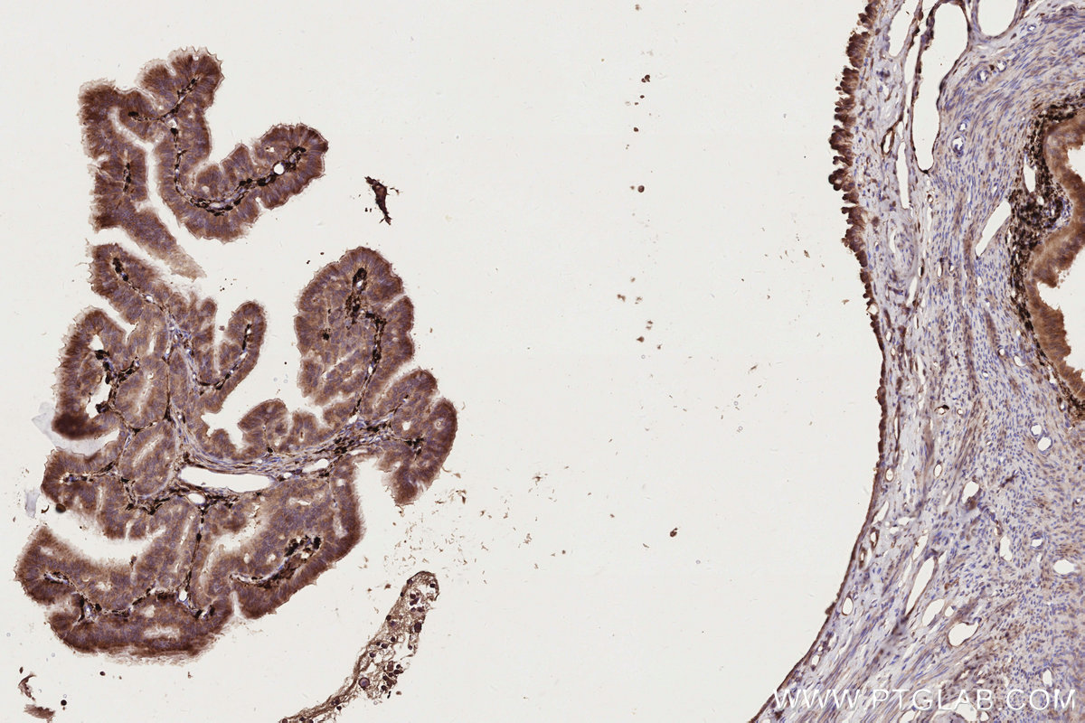 IHC staining of rat ovary using 68642-1-Ig IHC staining of rat ovary using 68642-1-Ig