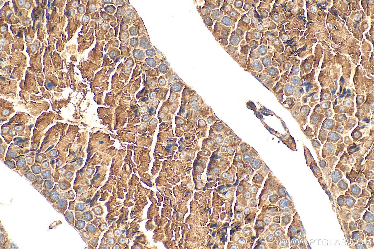 IHC staining of mouse testis using 31539-1-AP (same clone as 31539-1-PBS)