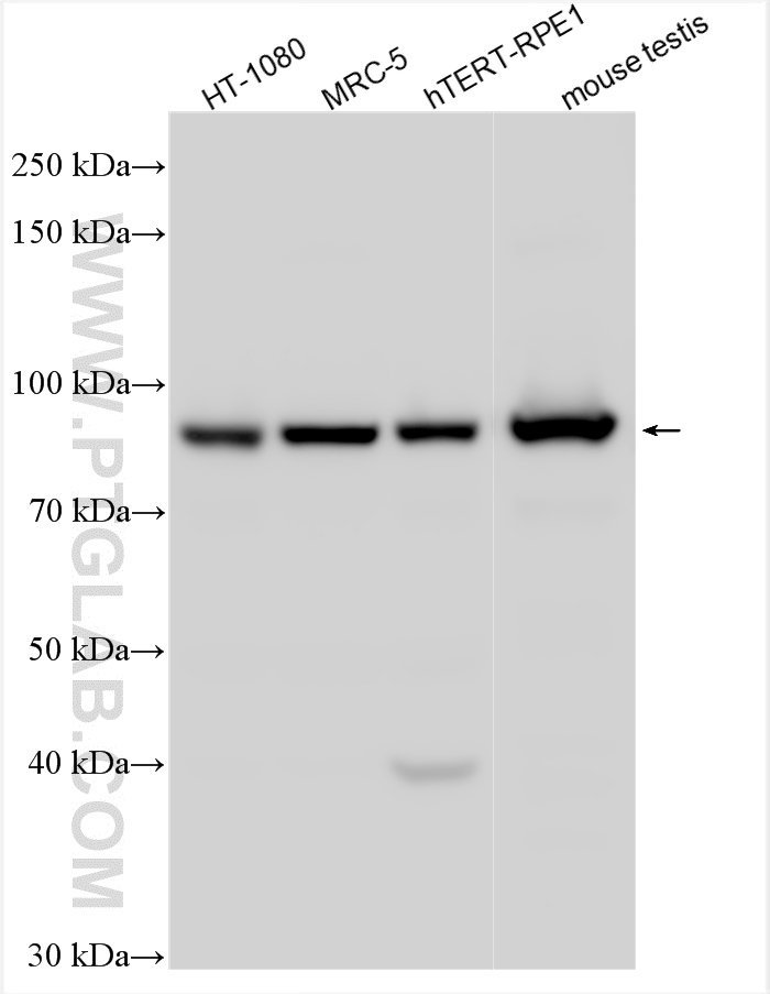 WB analysis using 31539-1-AP (same clone as 31539-1-PBS)