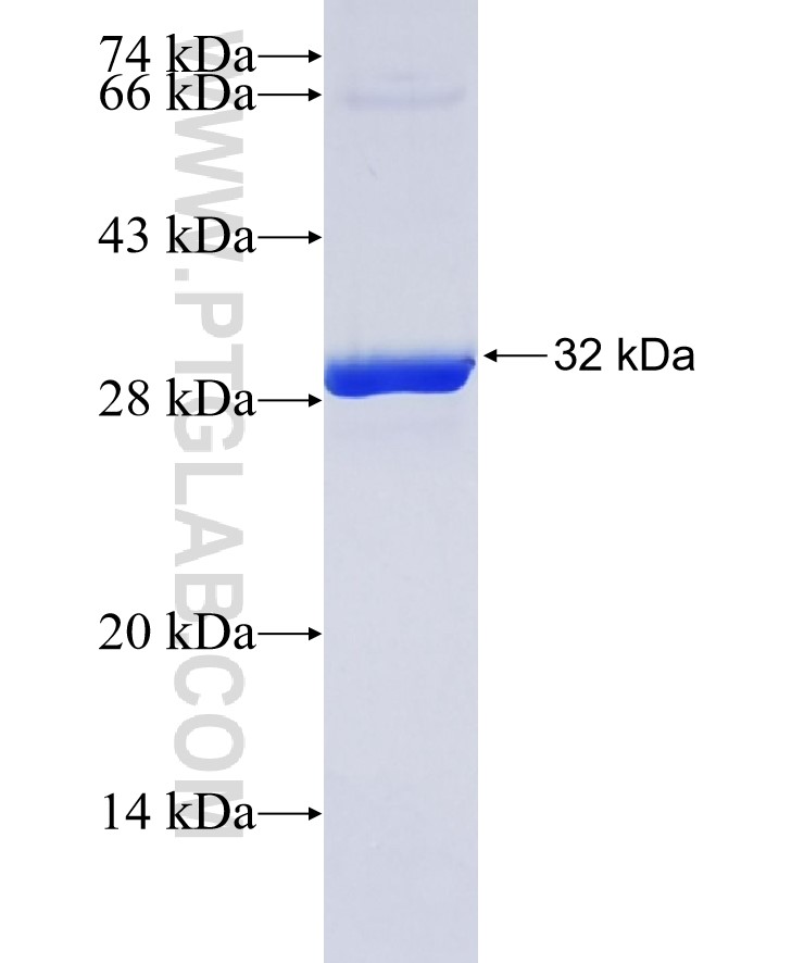COG4 fusion protein Ag37501 SDS-PAGE COG4 fusion protein Ag37501 SDS-PAGE