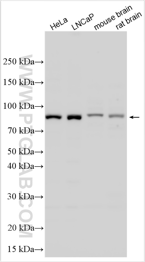 WB analysis using 31380-1-AP (same clone as 31380-1-PBS) WB analysis using 31380-1-AP (same clone as 31380-1-PBS)