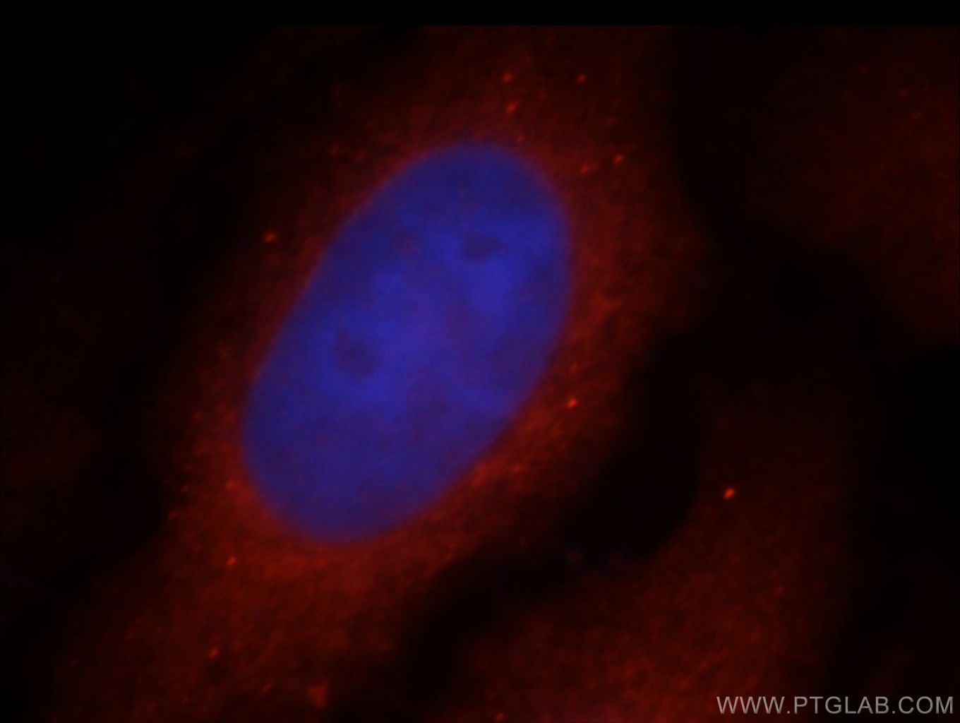 IF Staining of MCF-7 using 14277-1-AP