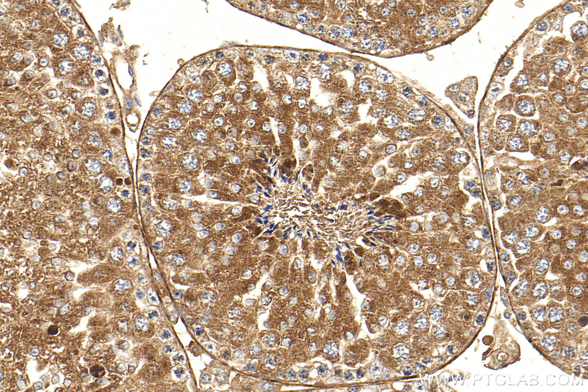 IHC staining of mouse testis using 12661-1-AP