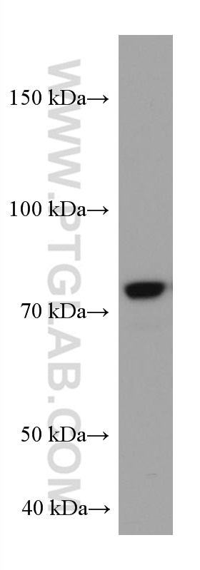 WB analysis of HeLa using 67218-1-Ig