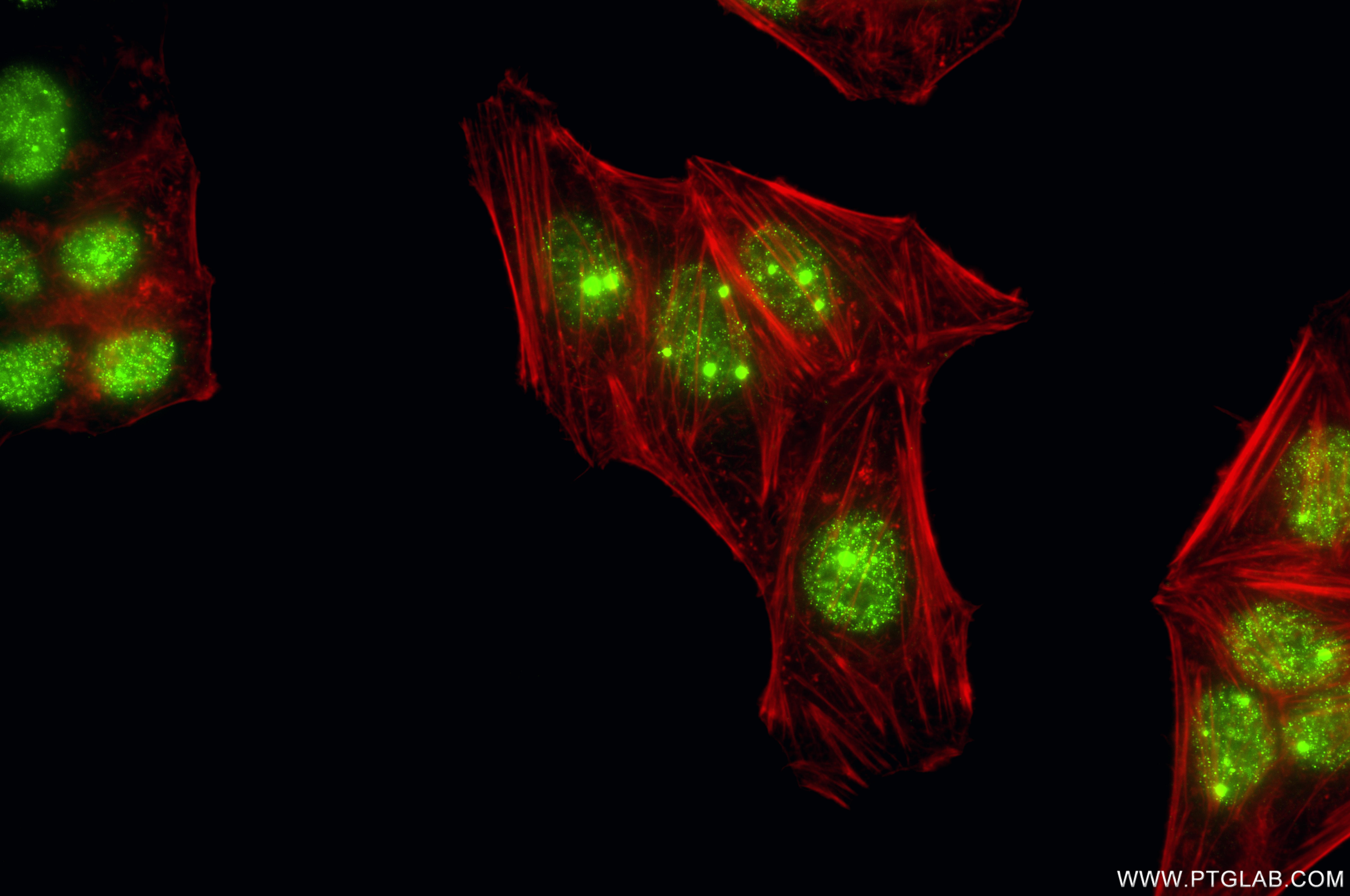 IF Staining of HepG2 using 87171-1-RR