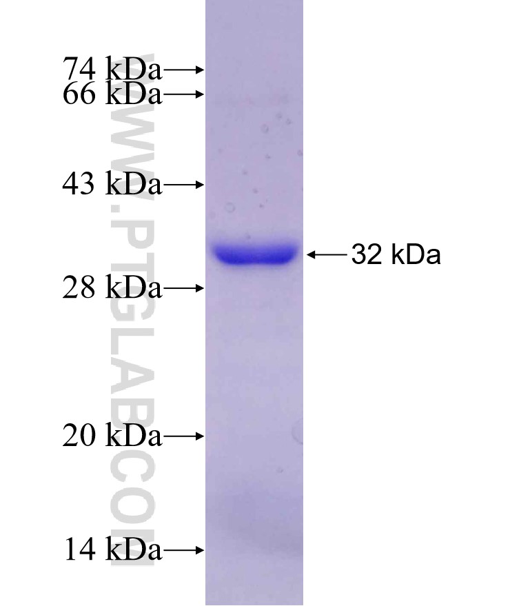 COL10A1 fusion protein Ag29739 SDS-PAGE